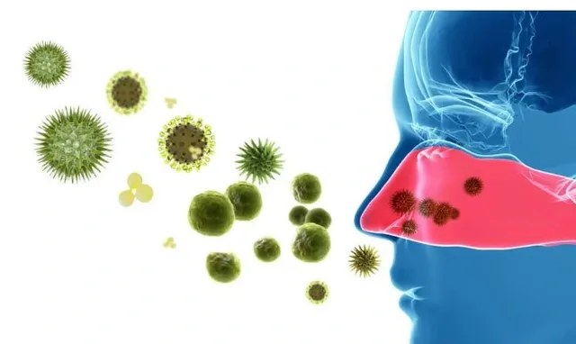Virus (Nguyên nhân phổ biến nhất)