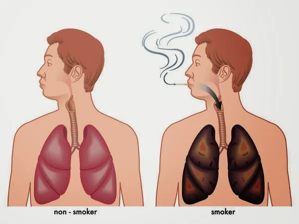 Tại sao cần làm sạch phổi tự nhiên?