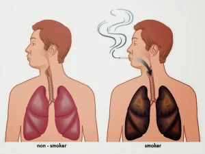 Cách làm sạch phổi tự nhiên