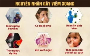 Nguyên nhân gây viêm xoang
