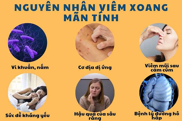 Các nguyên nhân gây viêm xoang phổ biến