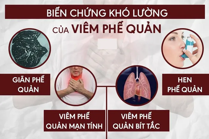 Triệu chứng viêm phế quản mãn tính