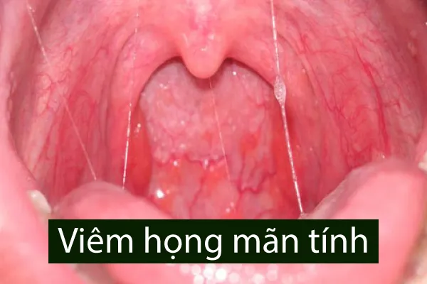 Ảnh hưởng đến chất lượng cuộc sống